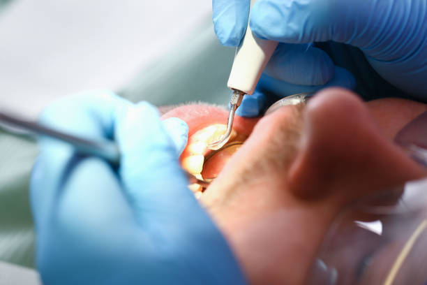 Best Orthodontic Emergency Dentist in Tama, IA