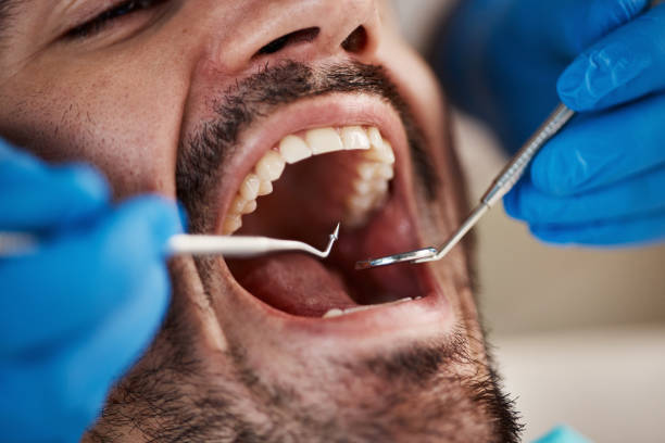 Best Emergency Dentist for Knocked-Out Tooth in Tama, IA